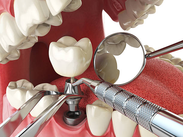 Best Emergency Dental Services for Seniors in Chalmette, LA